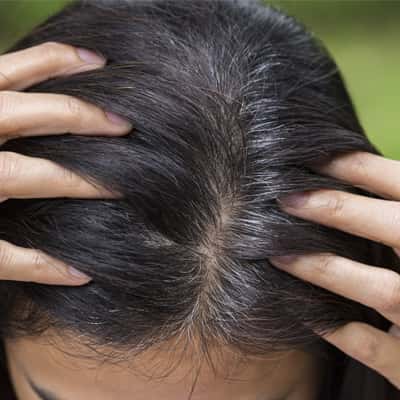 Gray Hair