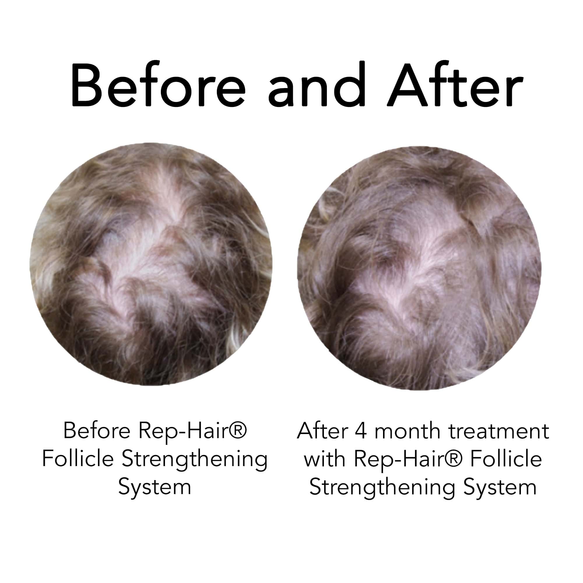 before and after
