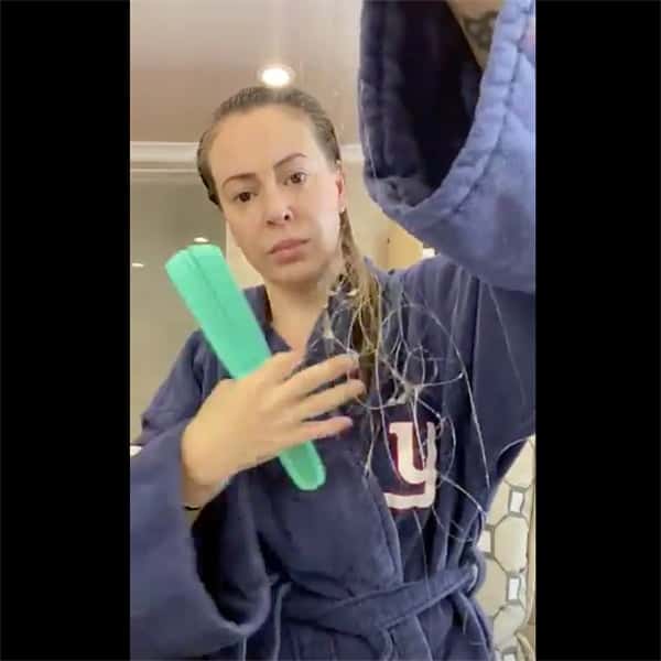 covid-hair-loss