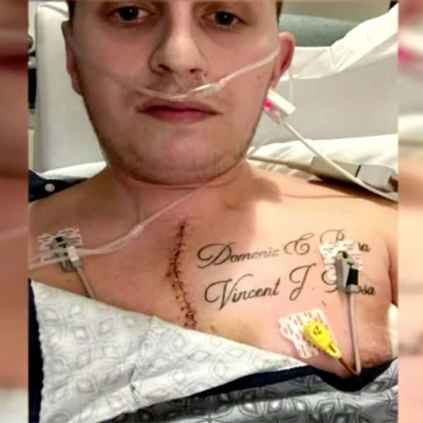 Barber Stabs Himself Freak Accident Boston With Scissors