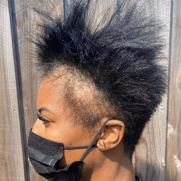 @theofficialrazorchic_hair_loss_6