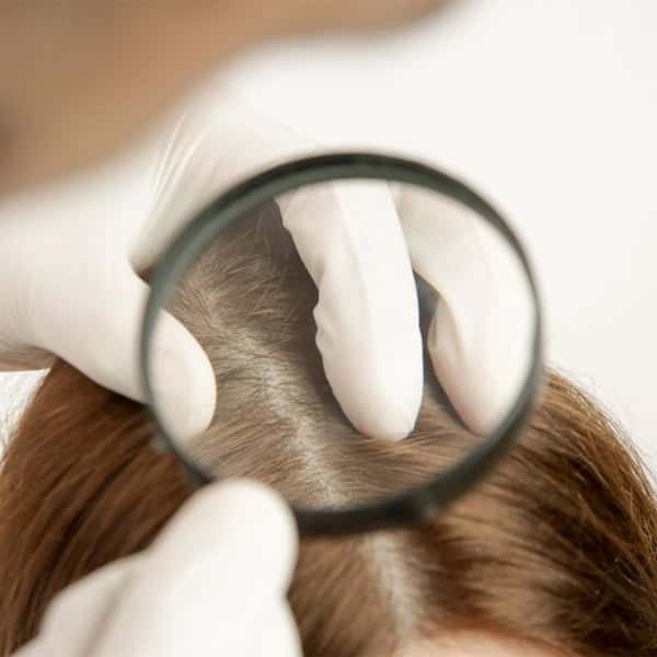 fine-hair-bosley-md