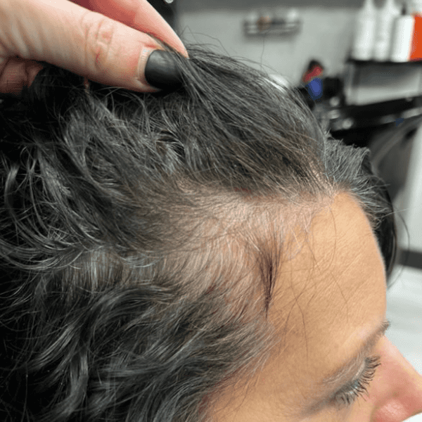 Close-up of a woman's hairline with gray growing in before using the SEVEN Haircare Satrara OPTI Serum