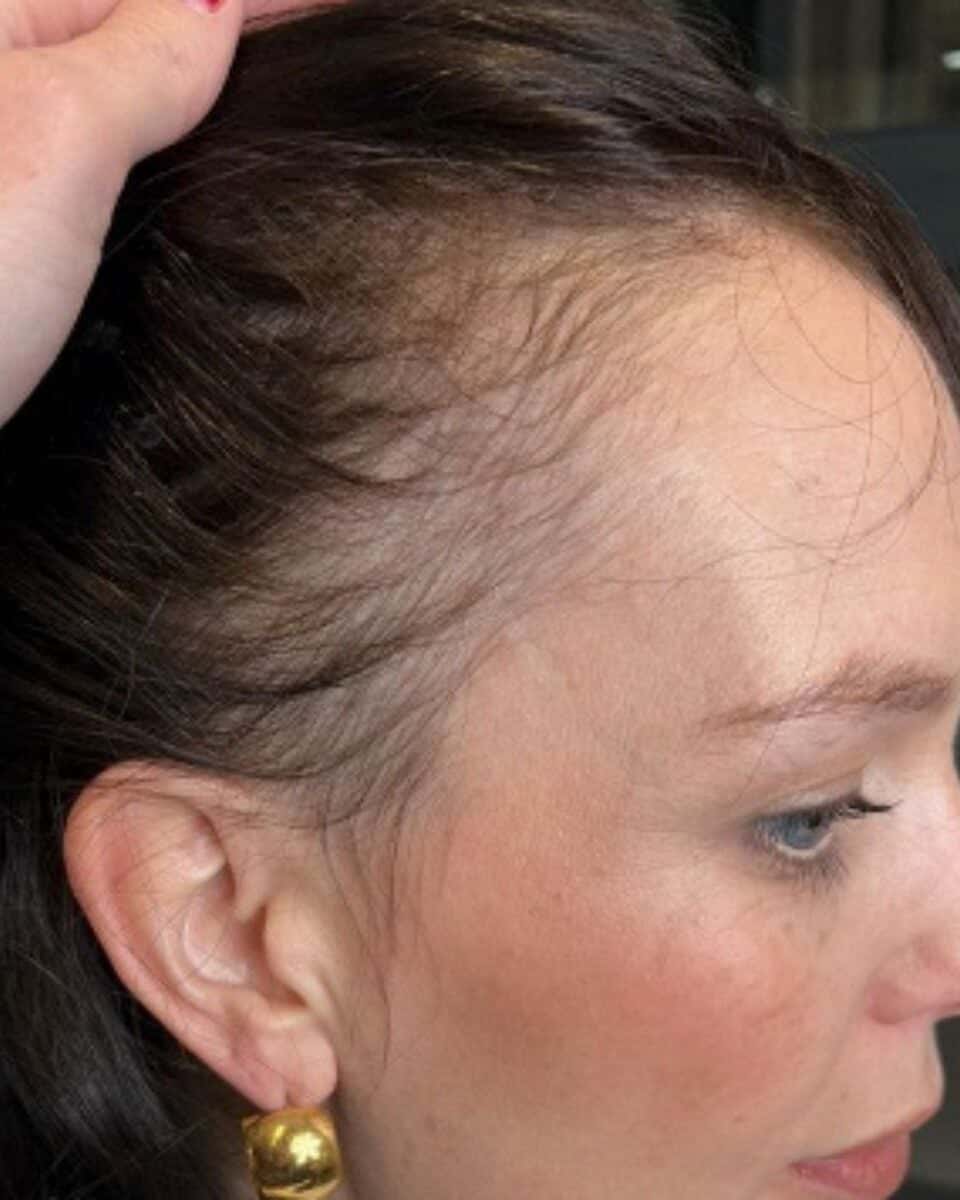 glowwa-hair-loss-article-1