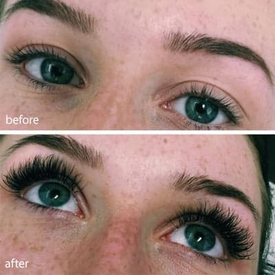 Novalash before and after