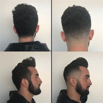 beforeafterfloyds_orig_large