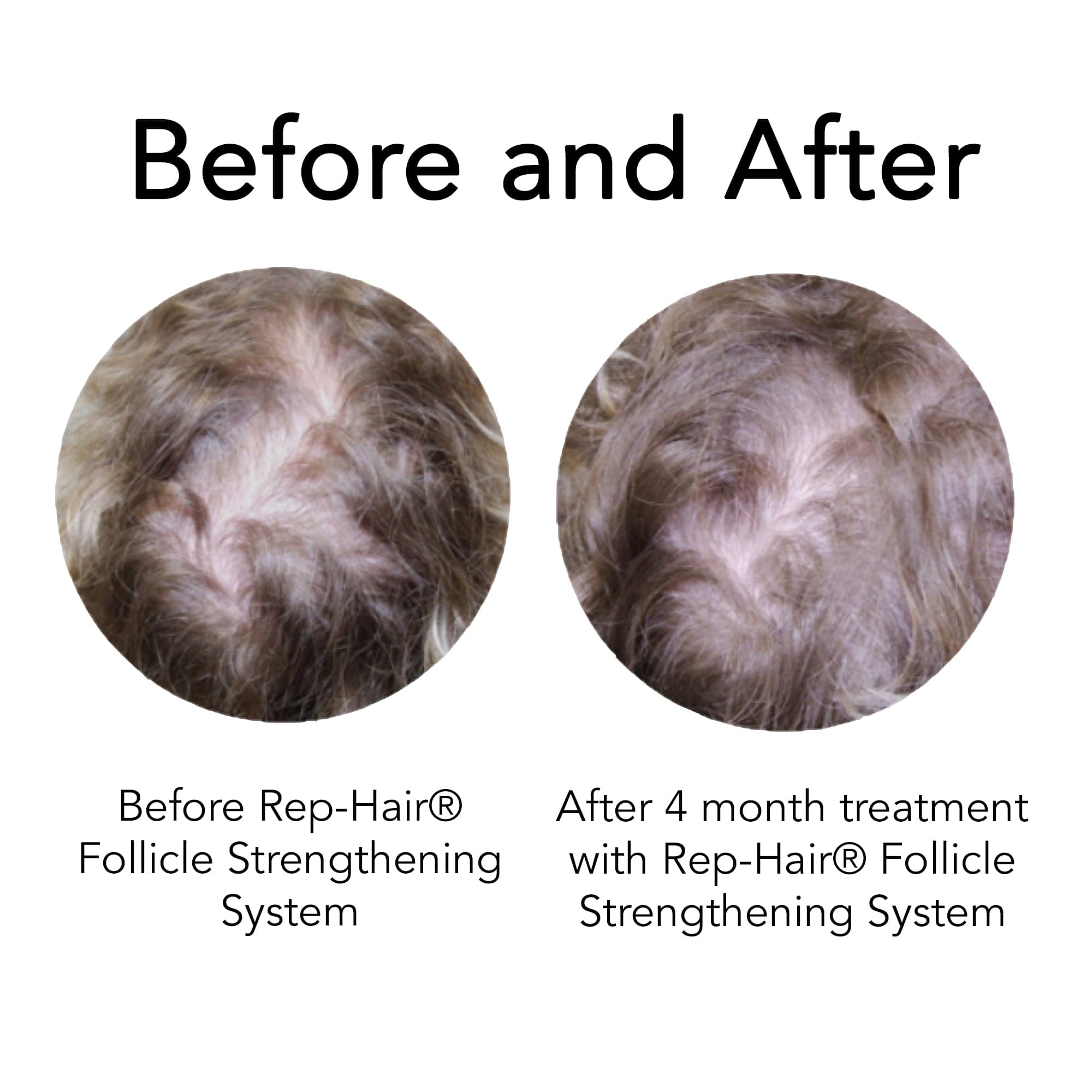 before and after