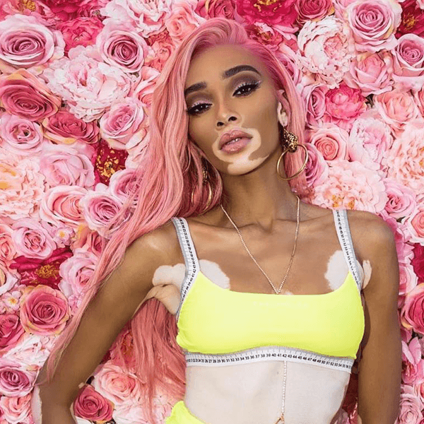 <p>Artist: <a href="https://www.instagram.com/winnieharlow/">@winnieharlow</a></p>
