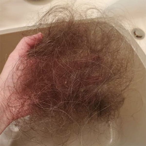 covid 19 coronavirus hair loss