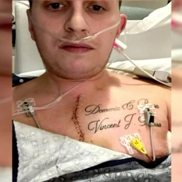 Barber Stabs Himself Freak Accident Boston With Scissors