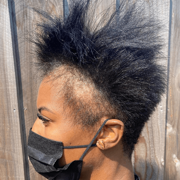 @theofficialrazorchic_hair_loss_6