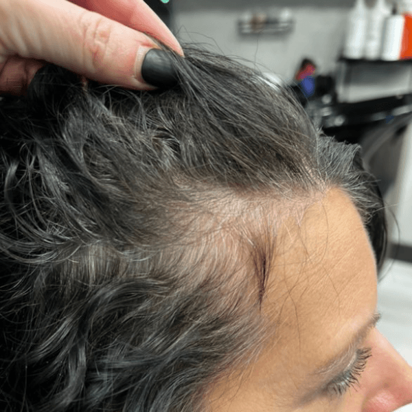 Close-up of a woman's hairline with gray growing in before using the SEVEN Haircare Satrara OPTI Serum