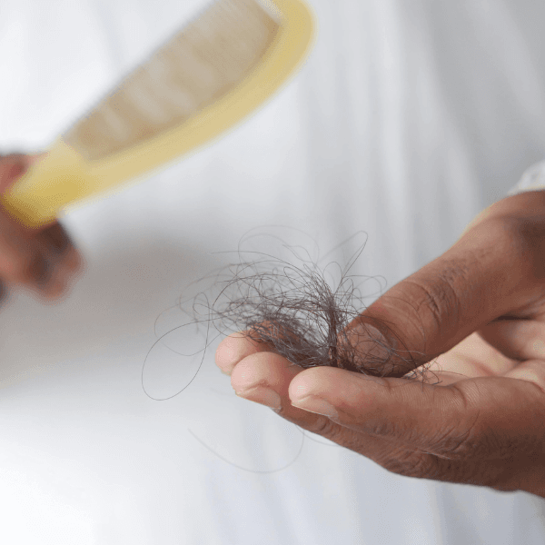Close-up of a person holding fallen hair with a comb in the background, representing postpartum hair loss and excessive shedding.