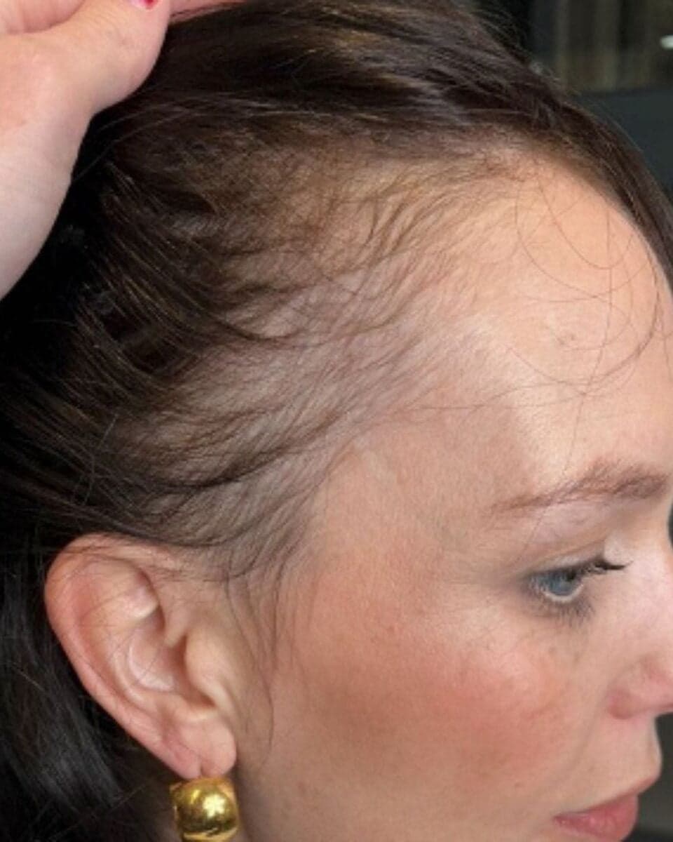 glowwa-hair-loss-article-1