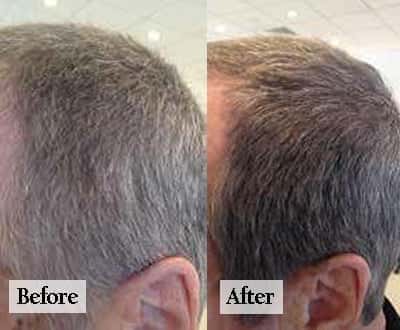 beforeandaftercolorwowmensgraycoverage_orig