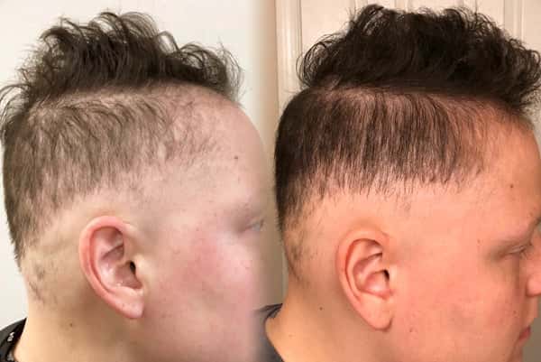 nioxin-tips-for-clients-with-alopecia-thin-hair-1