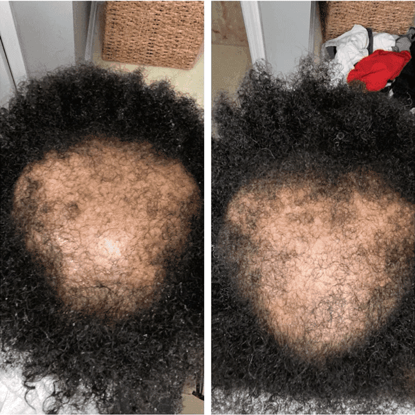 surface-awaken-scalp-facial-mrs-tahirah-2-feat